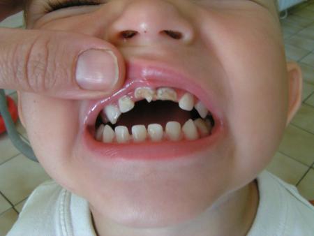Voilà mes dents 